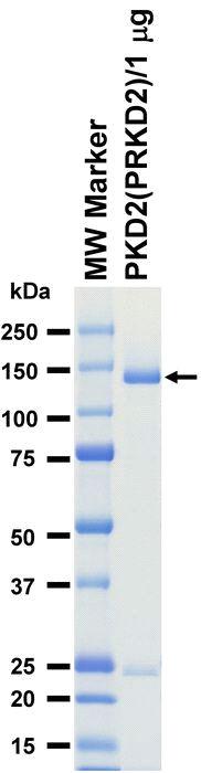 The purity was assessed by SDS-PAGE/CBB staining.